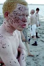 Watch Albino United Sflix