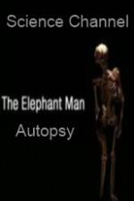 Watch Science Channel Elephant Man Autopsy Sflix