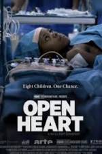 Watch Open Heart Sflix