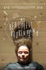 Watch My Beautiful Broken Brain Sflix