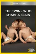 Watch National Geographic The Twins Who Share A Brain Sflix