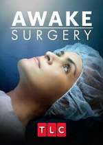 Watch Awake Surgery Sflix
